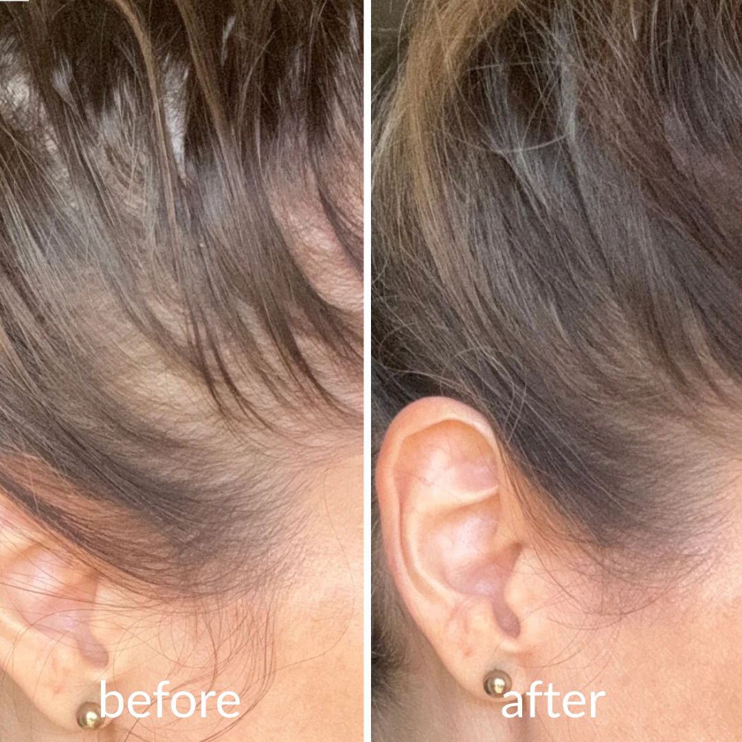 Levoya™ Korean Cooling Hair Ampoule