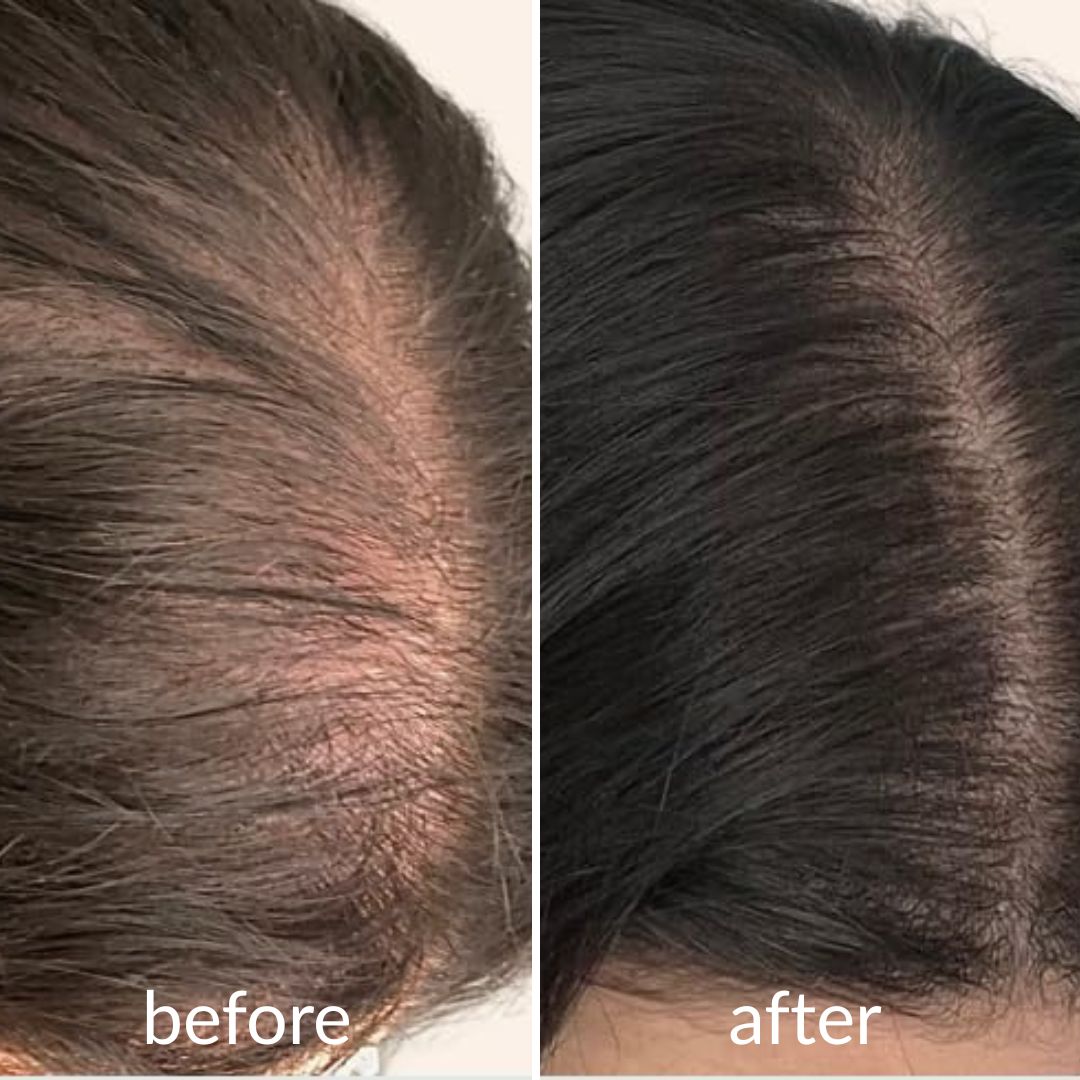 Levoya™ Korean Cooling Hair Ampoule
