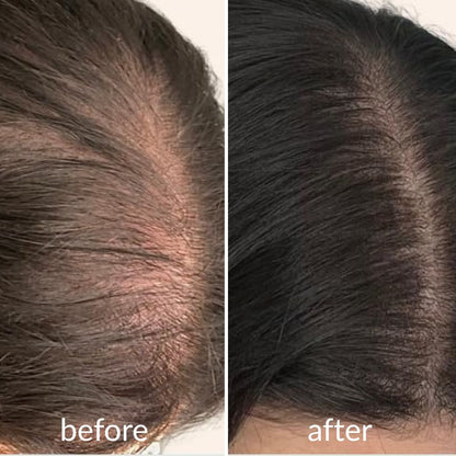 Levoya™ Korean Cooling Hair Ampoule