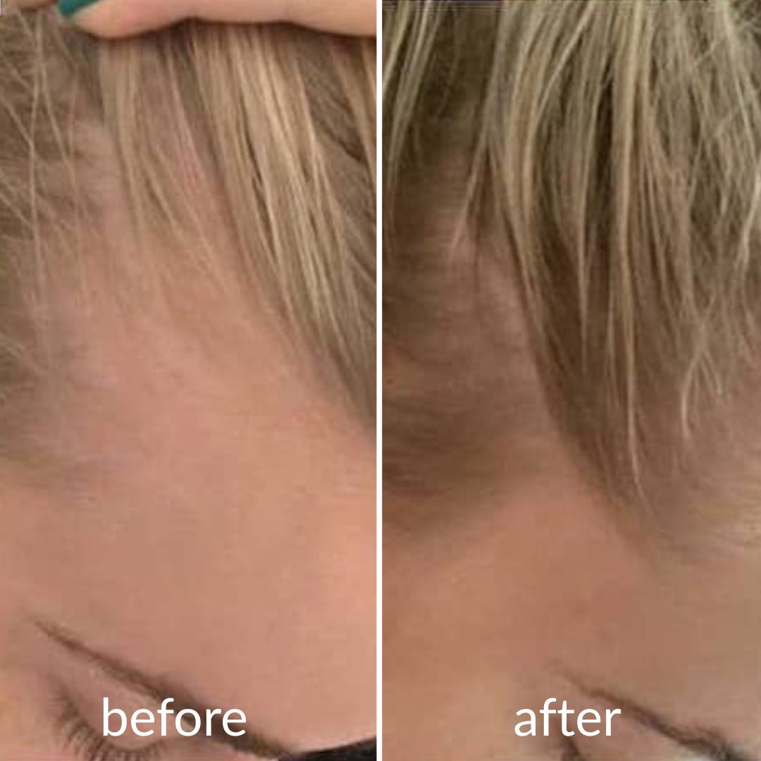 Levoya™ Korean Cooling Hair Ampoule