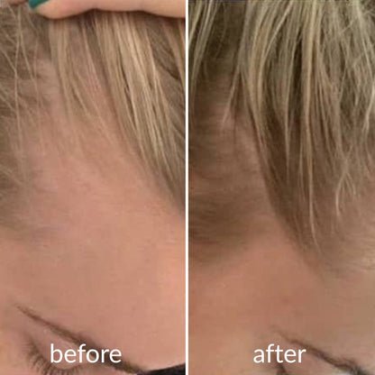 Levoya™ Korean Cooling Hair Ampoule