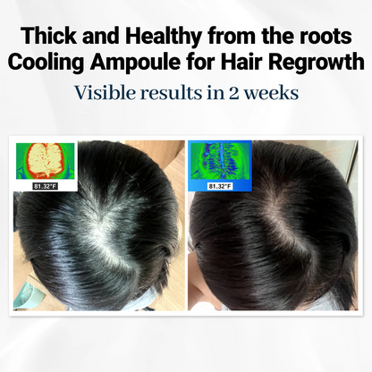 Levoya™ Korean Cooling Hair Ampoule
