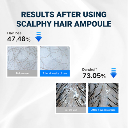 Levoya™ Korean Cooling Hair Ampoule